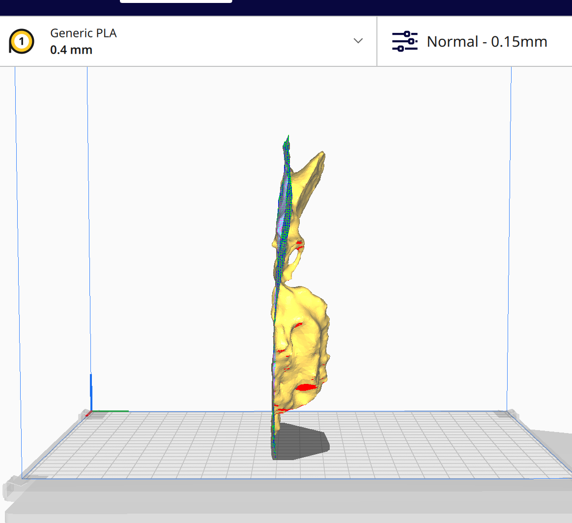 This is a side view of a badly scanned face's 3D model.